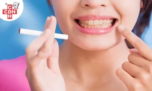 Can smoking causes yellowing of your teeth stain