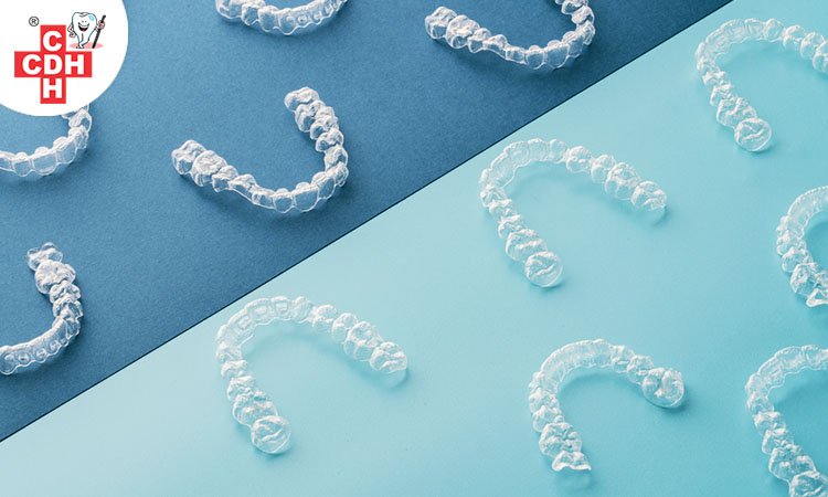 invisible aligners or braces invisible aligners or braces