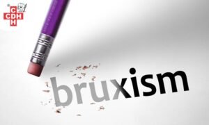 Bruxism in children causes and prevention