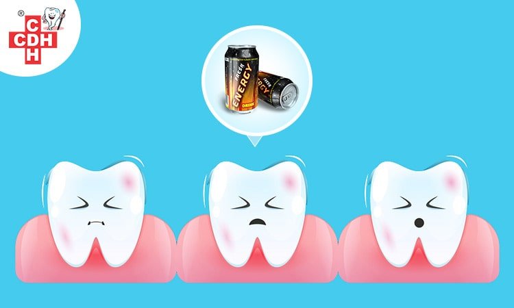 Energy drinks and your teeth