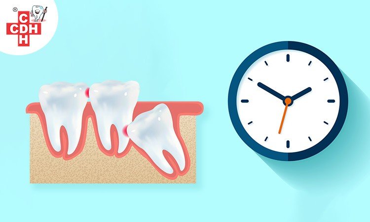 How much time does it take for wisdom teeth to appear