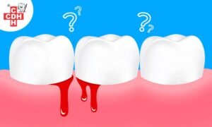 Is gum bleeding a normal problem