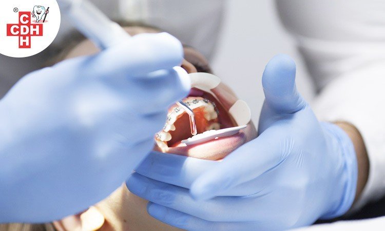 Dental health benefits of orthodontic treatment