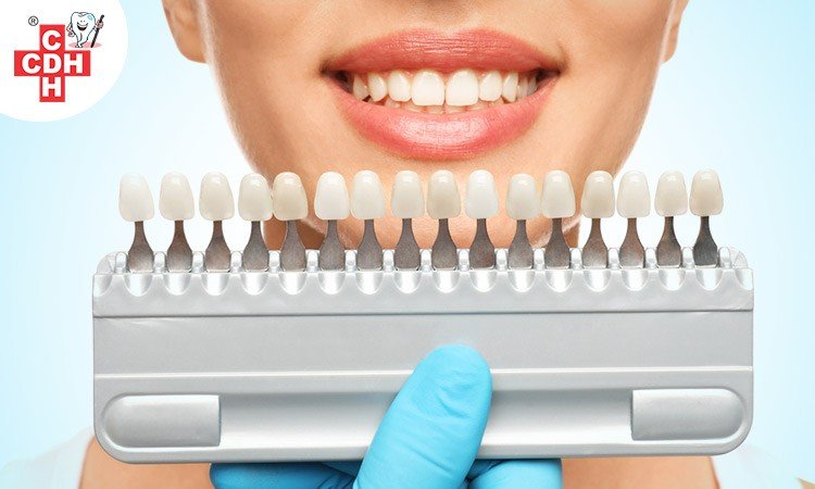 The benefits of cosmetic dentistry