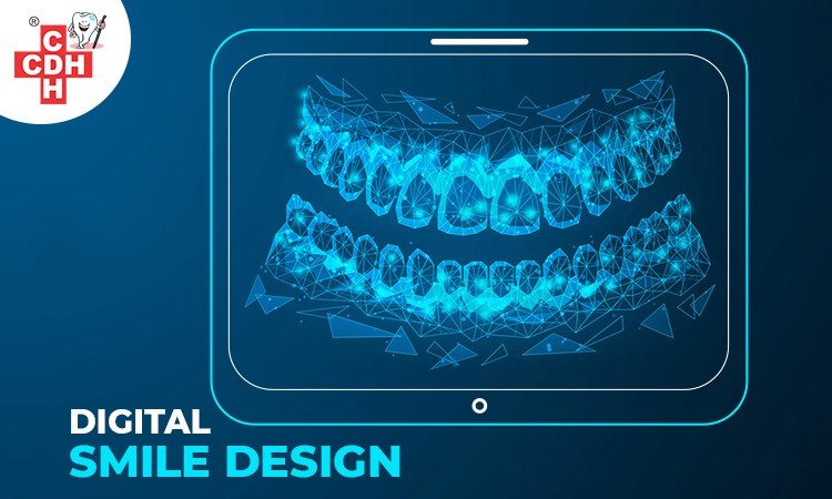 what-is-digital-smile-design-what-can-it-do-city-dental-hospital