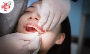 Wisdom tooth extraction. why it is done and what to do post surgery
