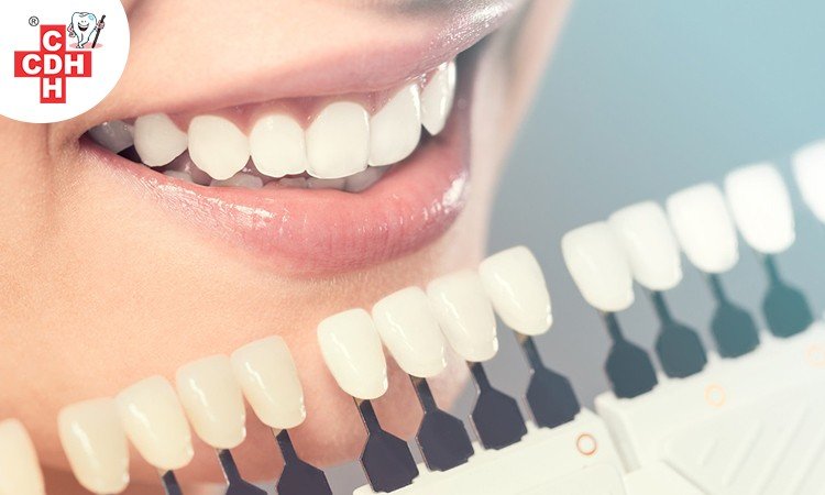 the types of cosmetic dentistry