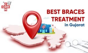 Best braces treatment