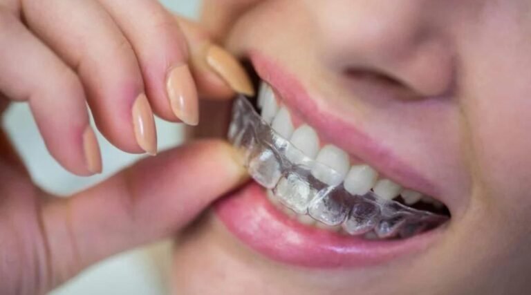 Braces Cost In India Teeth Braces Price In India braces-cost-in-india-teeth-braces-price-in-india