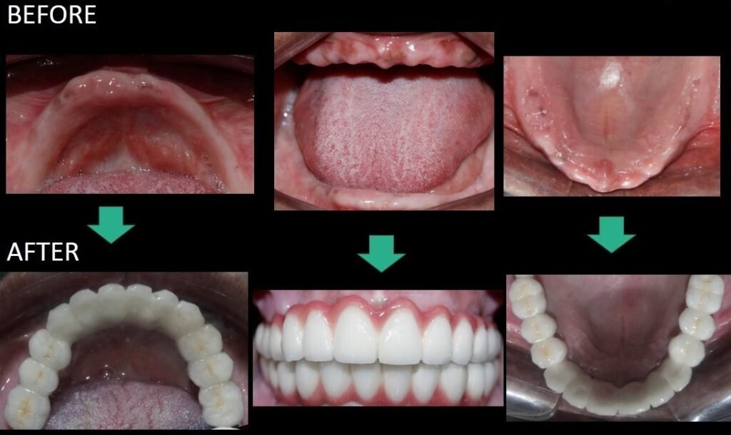 Improve Your tooth bleaching in Dwarka In 4 Days