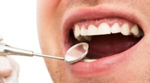 gum problems after implants