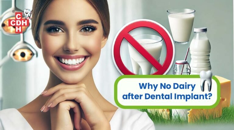 Why No Dairy after Dental Implant?