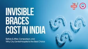 invisible braces cost in india