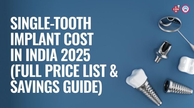 Single Tooth Implant Cost in india 2025