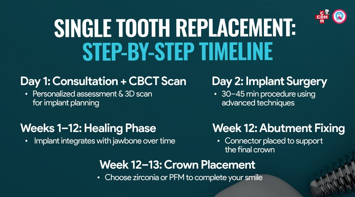 Single Tooth Implant Cost in india 2025 Step by step procedure timeline