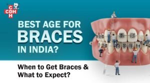 Best Age for Braces in India When to Get Braces & What to Expect