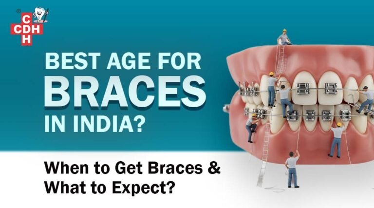 Best Age for Braces in India When to Get Braces & What to Expect