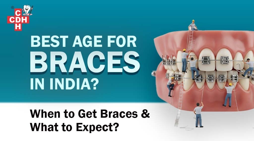 Best Age for Braces in India When to Get Braces & What to Expect