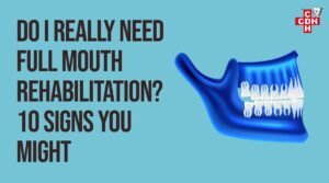 Do I Really Need Full Mouth Rehabilitation 10 Signs You Might