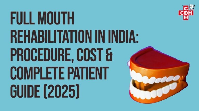 Full Mouth Rehabilitation in India Procedure, Cost, and Complete 2025 Patient Guide