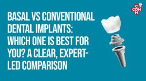 Basal vs Conventional Dental Implants Which One Is Best for You