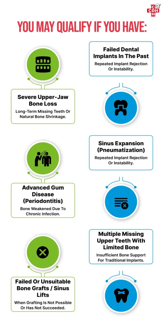 Infographic explaining who may qualify for zygomatic dental implants, including severe upper jaw bone loss, failed dental implants, sinus expansion, advanced gum disease, and unsuitable bone grafts