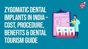 Illustration introducing zygomatic dental implants in India, covering cost, procedure, benefits, and dental tourism options