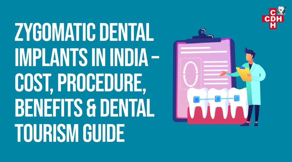 Illustration introducing zygomatic dental implants in India, covering cost, procedure, benefits, and dental tourism options