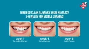 How Long Do Clear Aligners Really Take to Show Visible Results