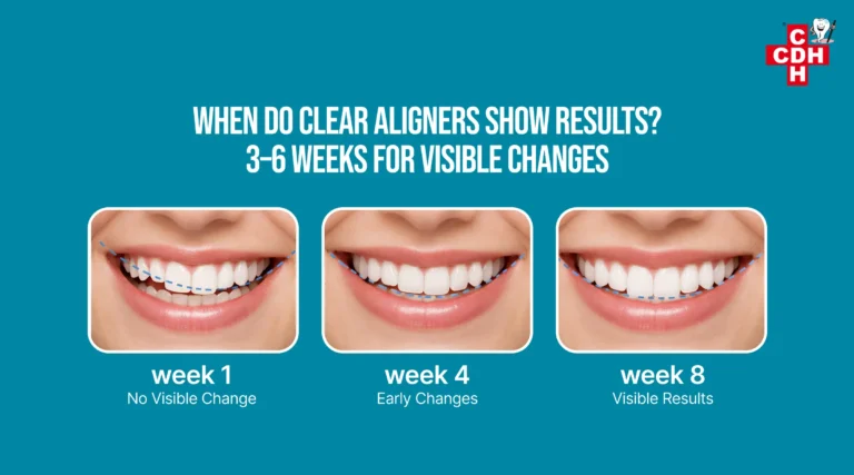 How Long Do Clear Aligners Really Take to Show Visible Results