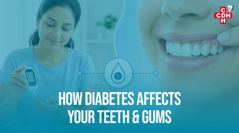 How Diabetes Affects Your Teeth and Gum